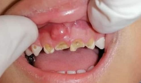 Imagen clínica de valoración dental